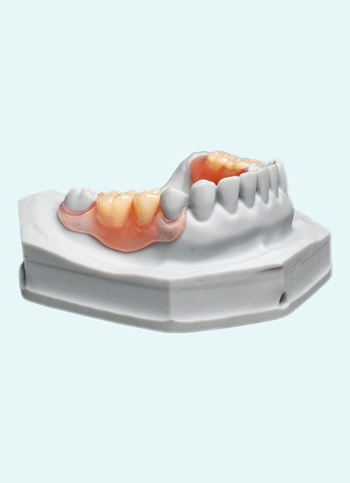 Protheses Valplast (Flexibel)