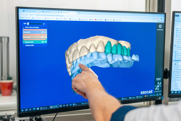 Smart-Dentals-3W-LR-33-1920x1080-B Smart-Dentals-3W-LR-33-1920x1080-B